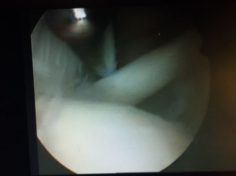 film2x